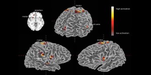 cervello, emozioni, musica, aree cerebrali, attivazione