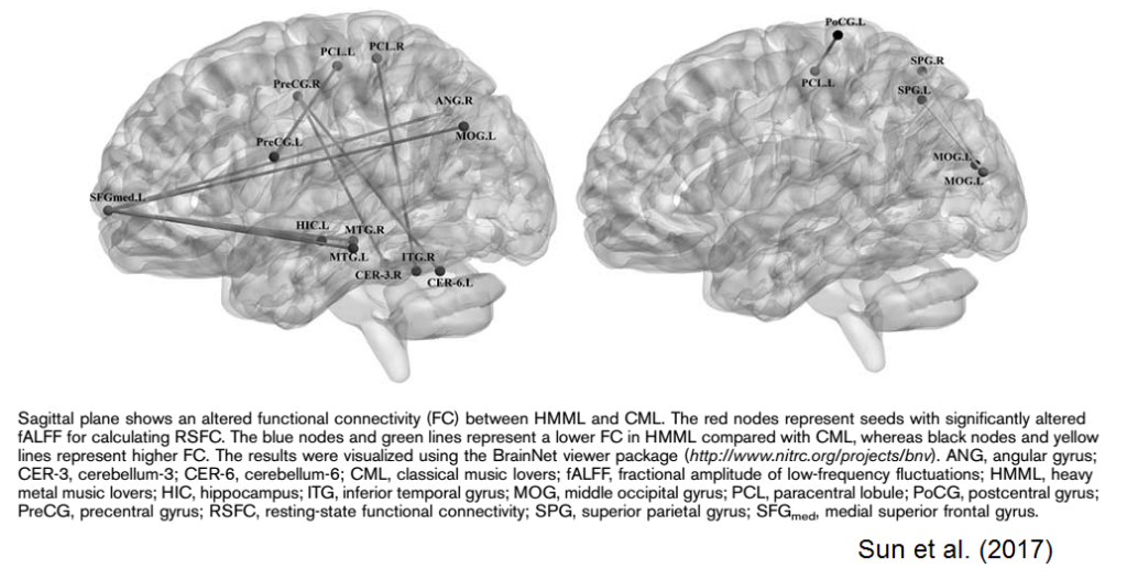 Heavy metal e disturbi cognitivi? Ma anche no!
